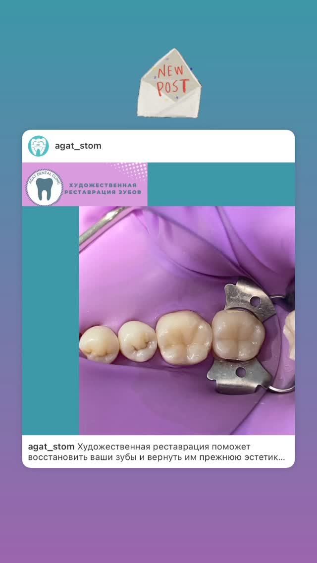 Протезирование