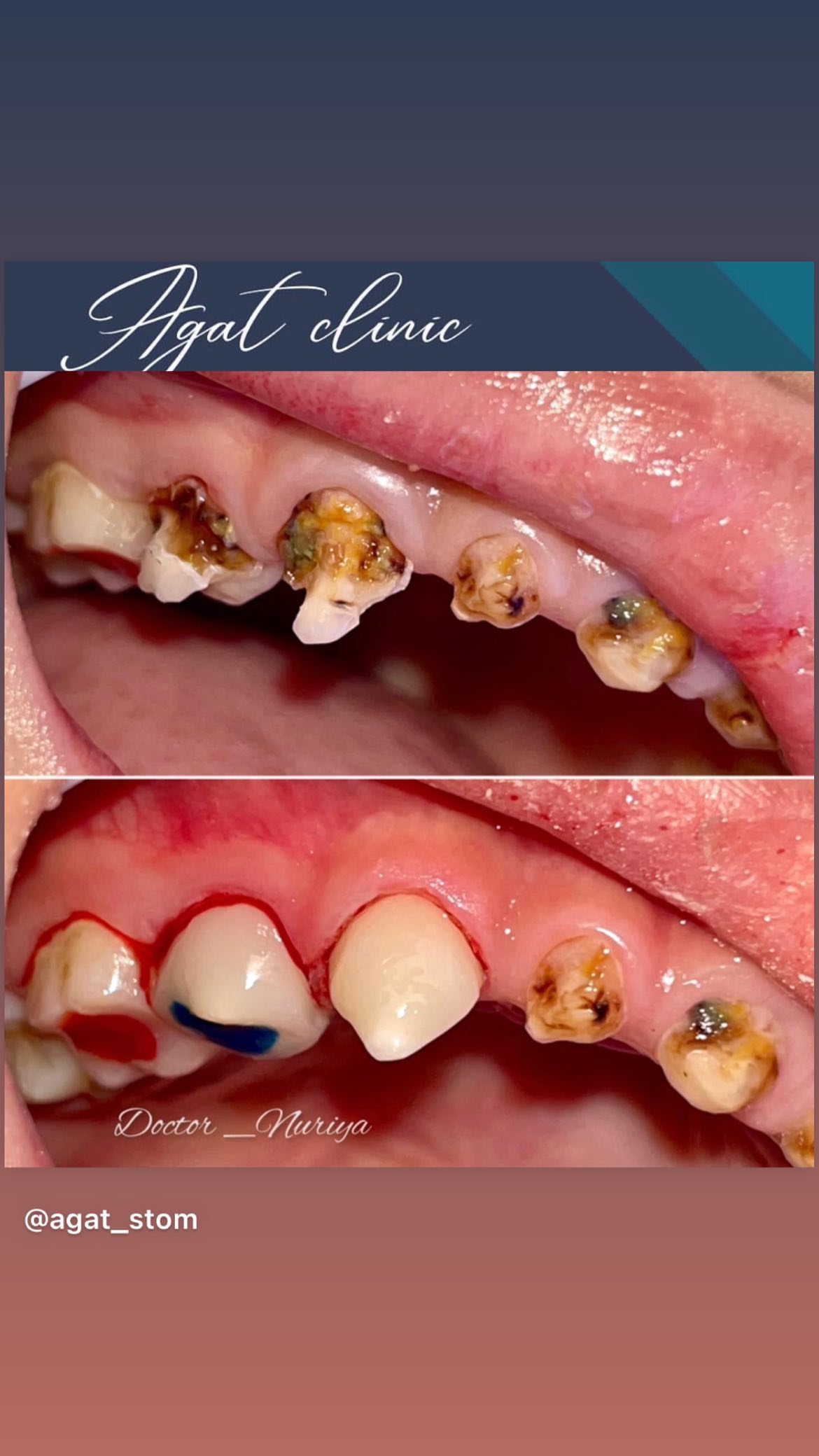 Детская стоматология