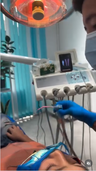 Имплантация зубов